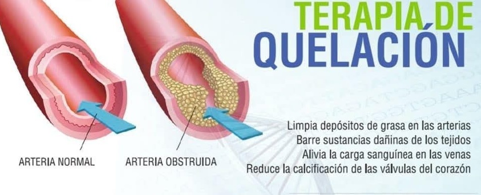 TERAPIA QUELACION 